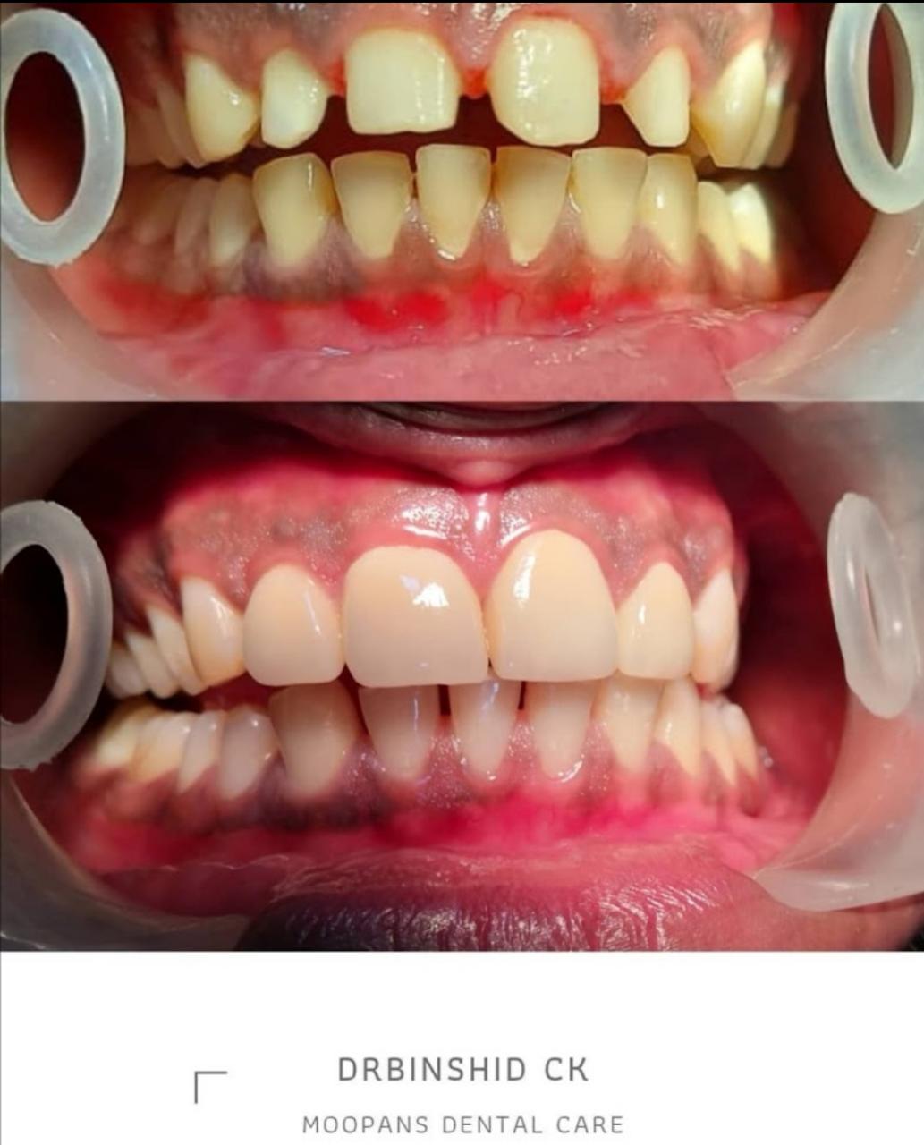 MOOPAN'S DENTAL CARE MONGAM