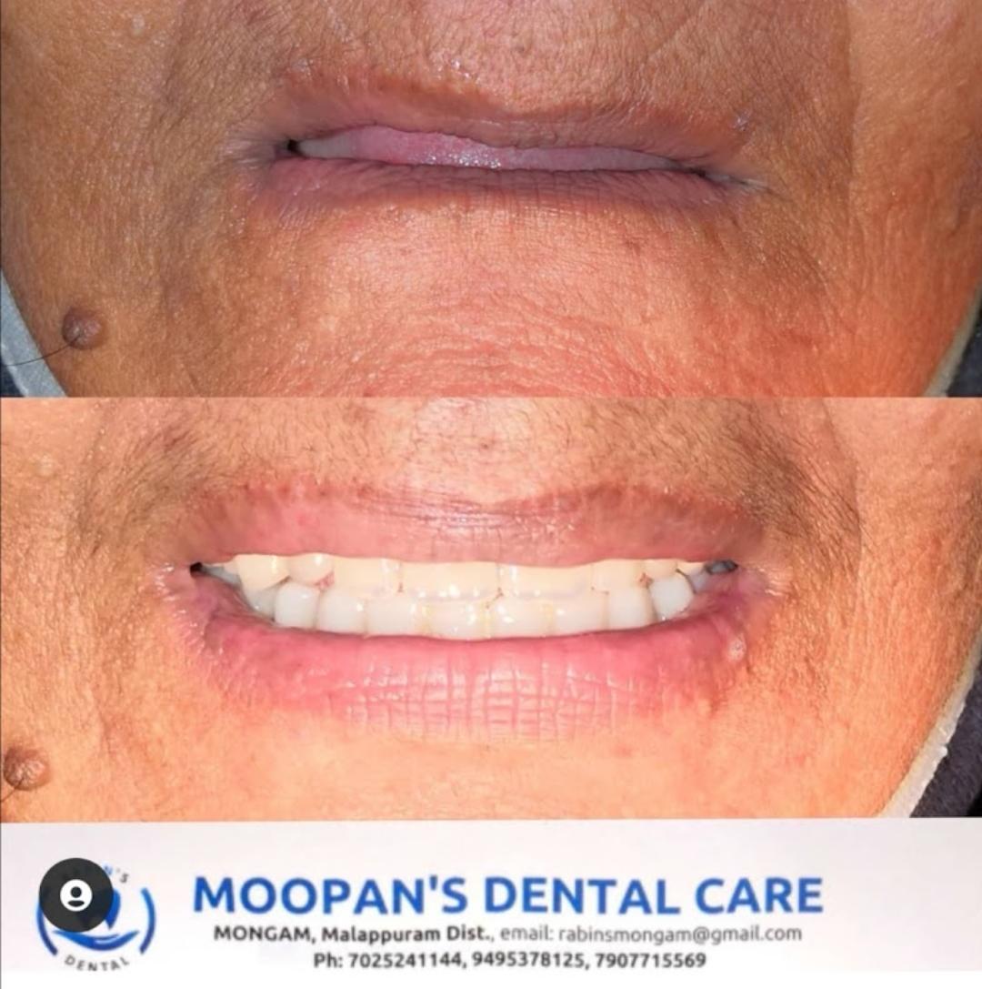 MOOPAN'S DENTAL CARE MONGAM