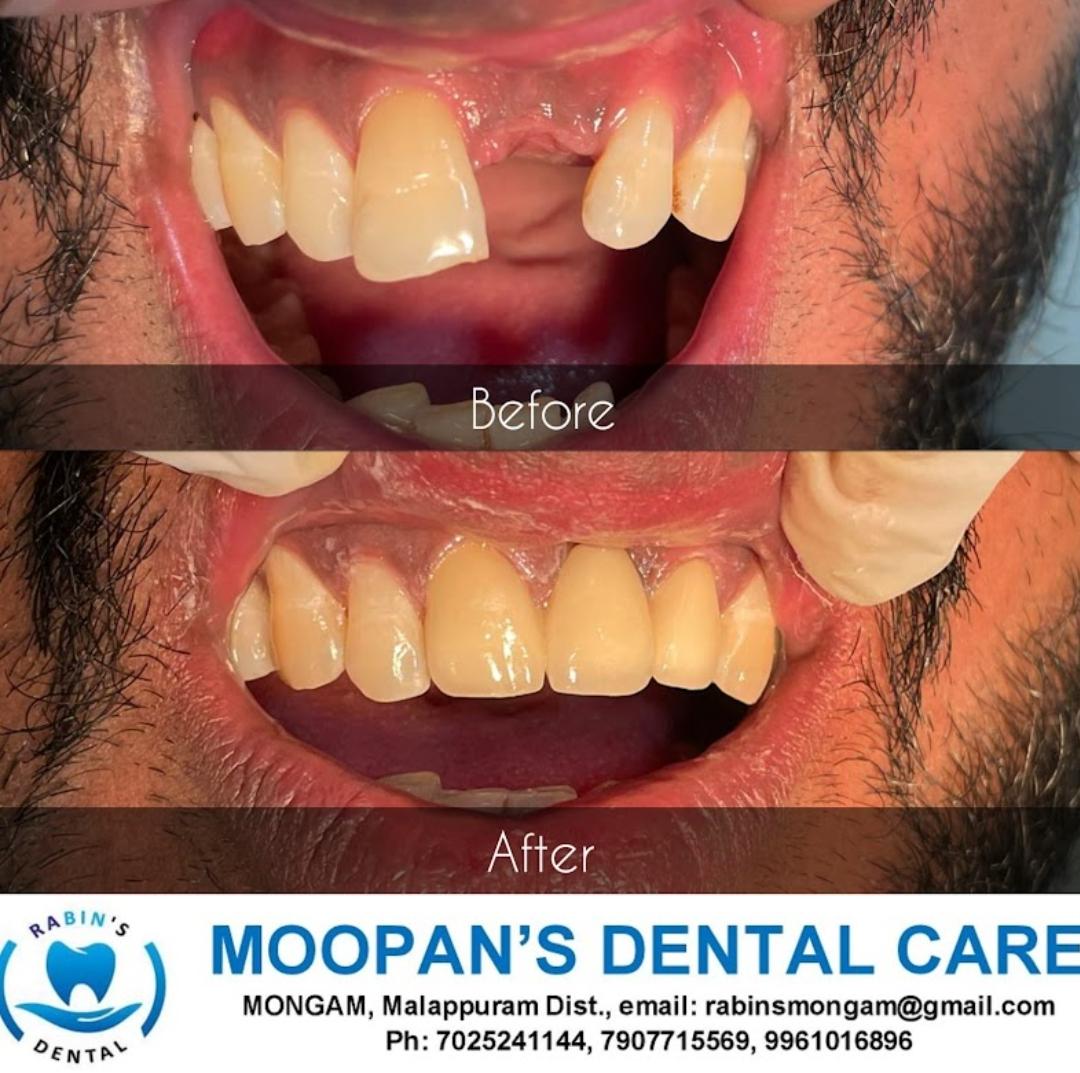MOOPAN'S DENTAL CARE MONGAM
