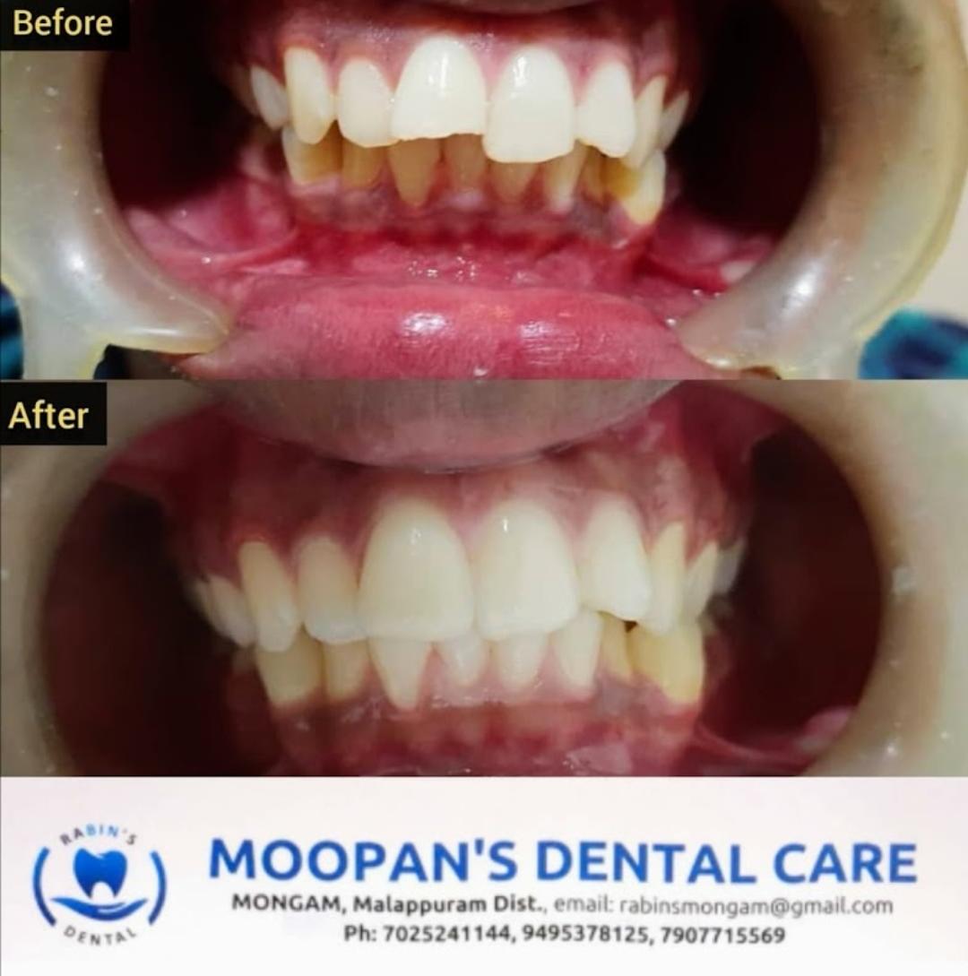 MOOPAN'S DENTAL CARE MONGAM