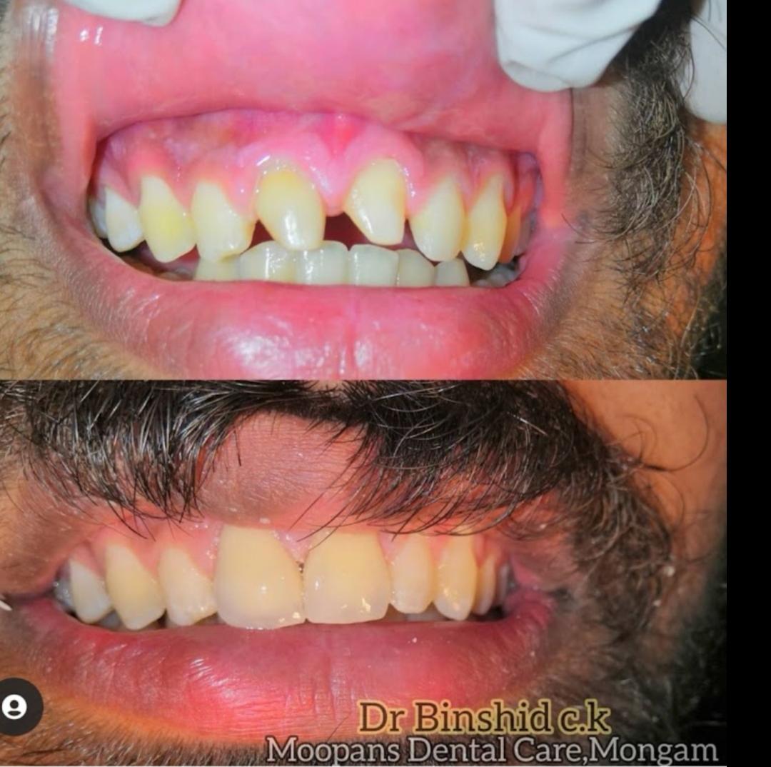 MOOPAN'S DENTAL CARE MONGAM