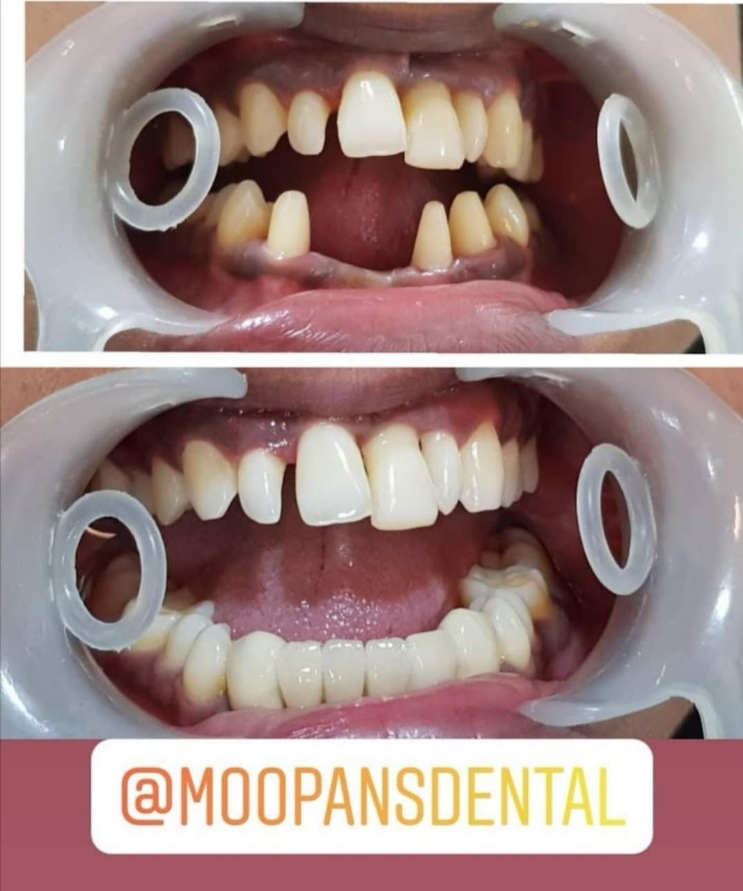 MOOPAN'S DENTAL CARE MONGAM