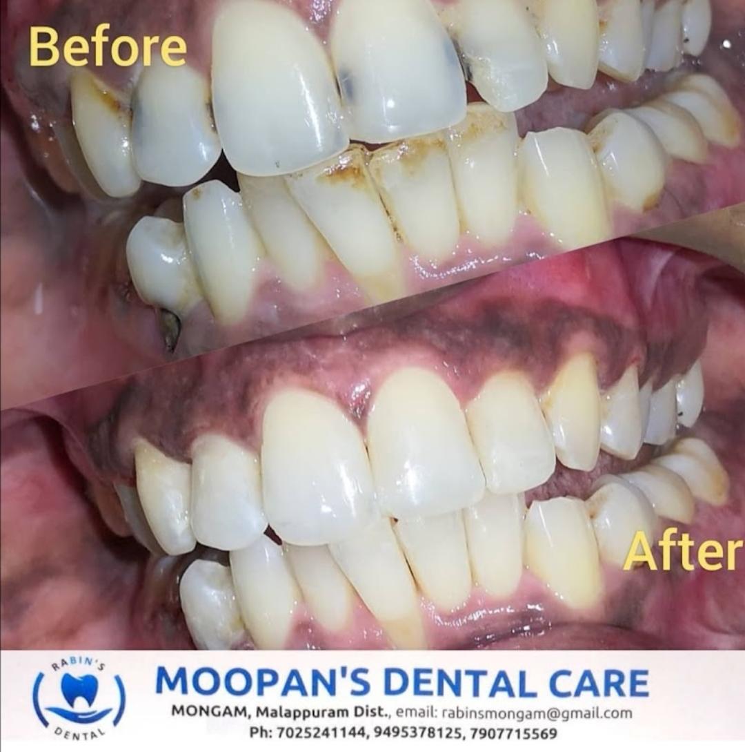 MOOPAN'S DENTAL CARE MONGAM