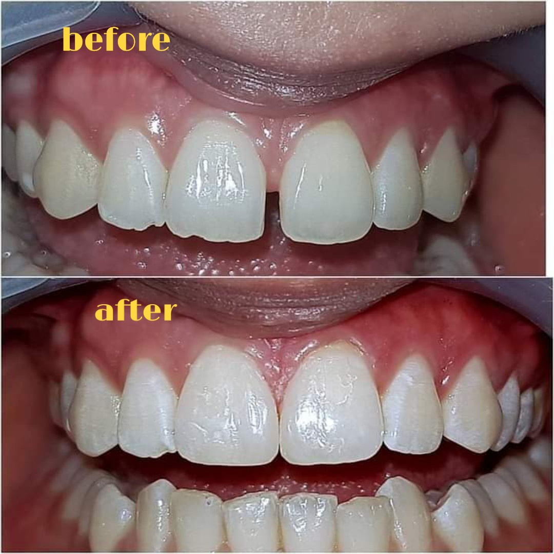 MOOPAN'S DENTAL CARE MONGAM